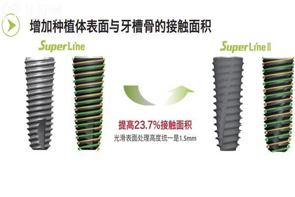 北京中諾口腔醫(yī)院種牙價(jià)格表2025