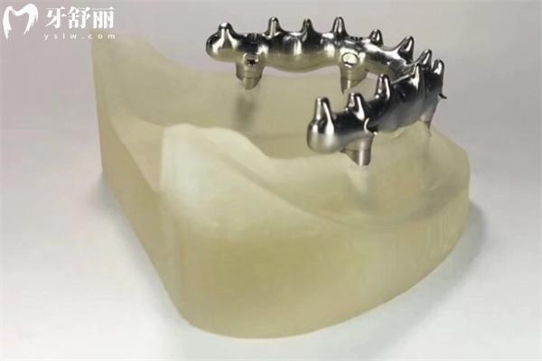 貴州牙科醫(yī)院價格表