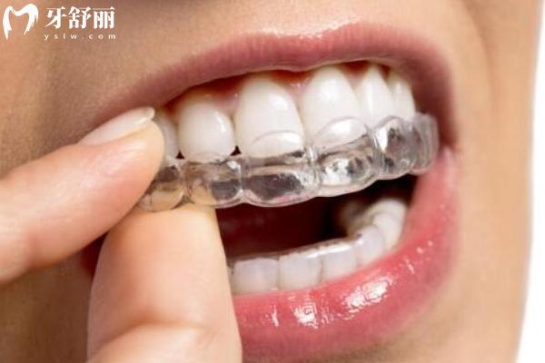宜春施美爾口腔收費(fèi)標(biāo)準(zhǔn)，補(bǔ)牙、種植、矯正、根管、拔牙等收費(fèi)全知曉