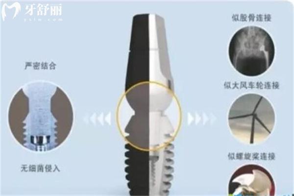 天津種植牙齒多少錢一顆?25年價(jià)格一覽表顯示1880元/顆起附正規(guī)口碑牙科醫(yī)院