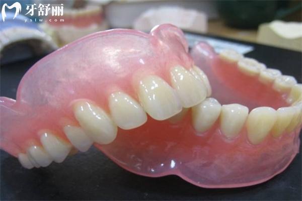 為什么不鼓勵(lì)年輕人用活動(dòng)假牙呢?了解戴活動(dòng)假牙的好處和壞處后便知道啦