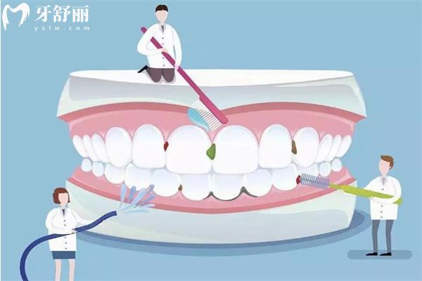 北京牙科收費價目表2025:含種牙/矯正/補(bǔ)牙/根管治療/鑲牙等項目參考價目表