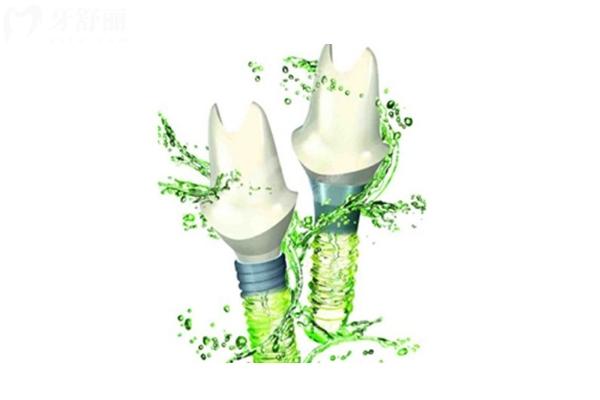 2025湛江珠江口腔價目表更新，美白矯正補牙拔牙種植修復兒牙價格