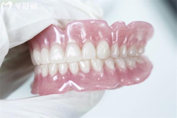 吸附式假牙的優(yōu)點(diǎn)和缺點(diǎn)是什么?究竟值不值得選?帶你解析詳細(xì)優(yōu)缺點(diǎn)與選擇指南