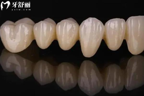 2025保定嘉和口腔收費(fèi)標(biāo)準(zhǔn)，種植牙、牙齒矯正、補(bǔ)牙、拔牙、鑲牙等價(jià)格