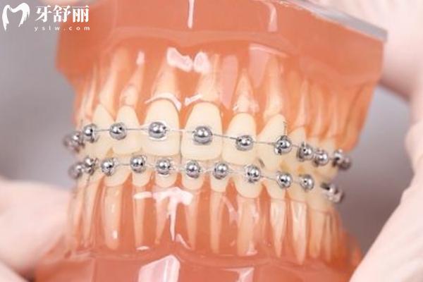 楚雄牙科矯正醫(yī)院哪家比較好