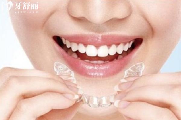 蘇州牙齒矯正哪個醫(yī)院好