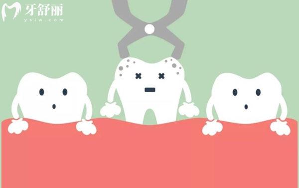超聲骨刀拔智齒和傳統(tǒng)拔智齒哪個(gè)好?介紹這兩者的區(qū)別/優(yōu)缺點(diǎn)/價(jià)格