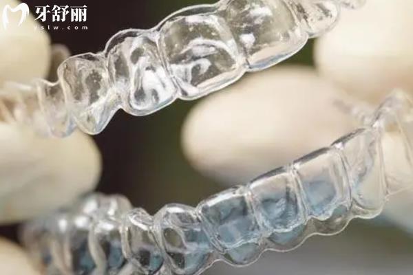 時(shí)代天使四大版本