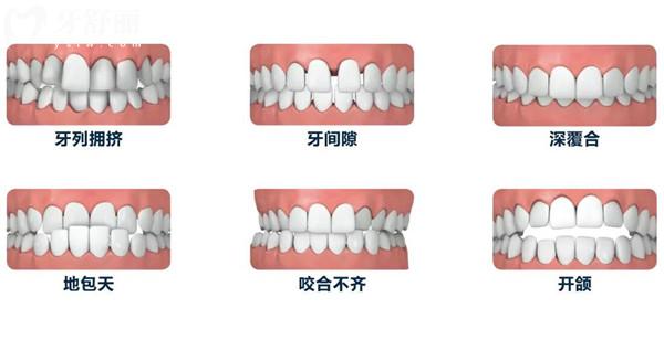 福州美可普口腔2025收費(fèi)標(biāo)準(zhǔn)調(diào)整(種植牙/正畸/牙冠/補(bǔ)牙/拔牙收費(fèi)明細(xì)一覽)