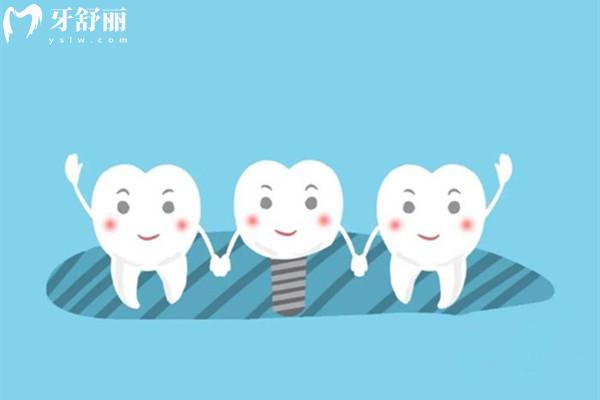 瑞典astra和瑞士iti種植體哪個(gè)好