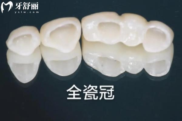 德國牙冠哪家強(qiáng)？