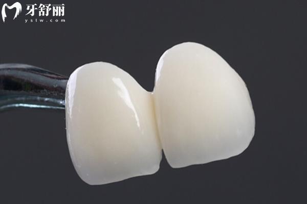 德國牙冠哪家強(qiáng)？