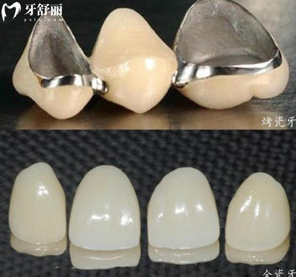 2025深圳牙科醫(yī)院收費(fèi)價(jià)目表出爐!及深圳正規(guī)10大牙科醫(yī)院名單