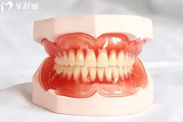 北京裝一副假牙要多少錢