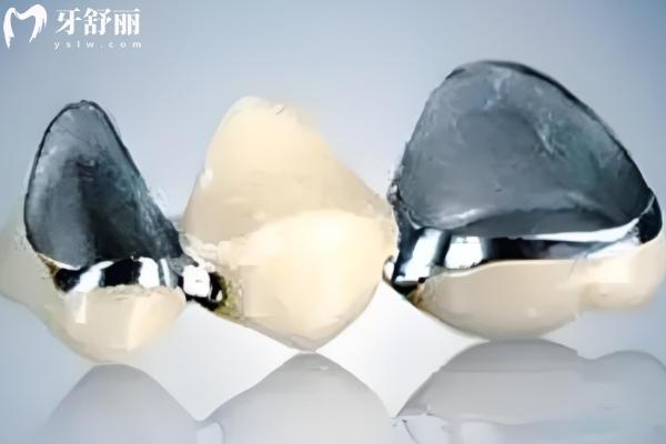 北京裝一副假牙要多少錢
