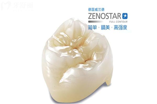 德國(guó)威蘭德全瓷牙多少錢(qián)一顆?三大系列價(jià)格2500-5000元不等辨別真假方法送上
