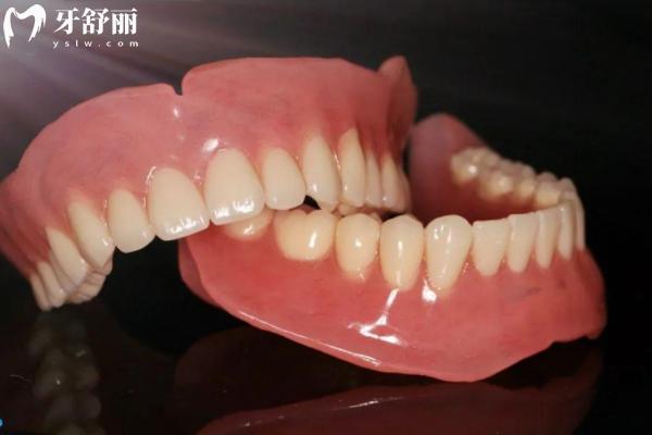 瑞士義獲嘉BPS吸附性義齒優(yōu)缺點