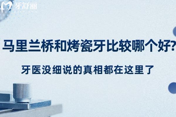 馬里蘭橋和烤瓷牙比較哪個(gè)好?牙醫(yī)沒(méi)細(xì)說(shuō)的真相都在這里了  