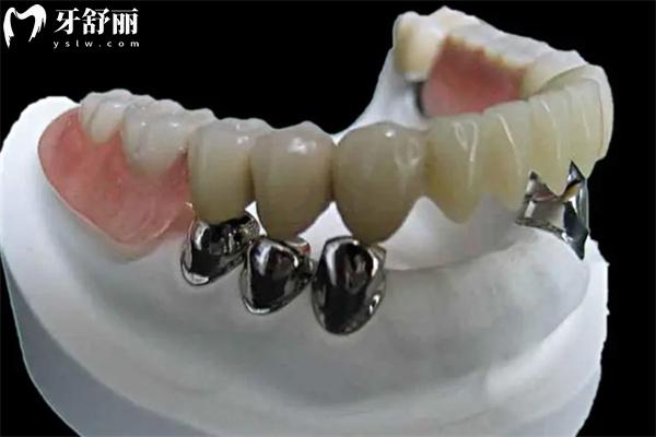 上海做全口義齒的醫(yī)院排名前十公布:想要技術(shù)好價格還不貴選著幾家錯不了