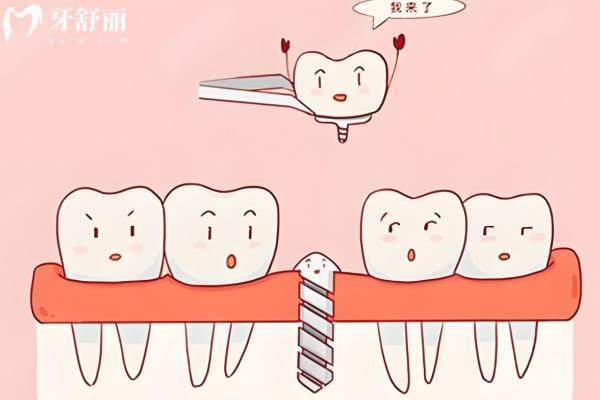 什么是莆田系醫(yī)院?莆田系口腔醫(yī)院是什么性質的醫(yī)院?五招教你識破莆田系口腔醫(yī)院