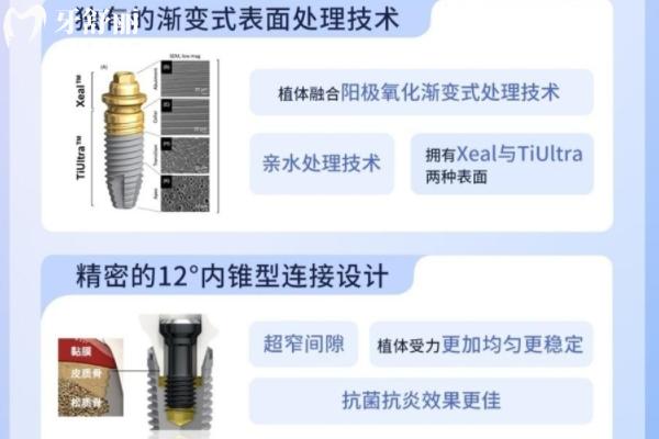 目前比較好的種植牙品牌有哪些？