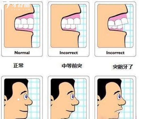 2025年正頜手術(shù)能報銷嗎