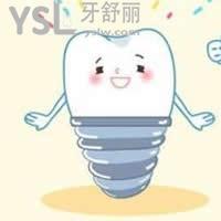 登特斯種植體