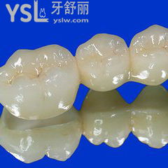 聚合瓷全瓷牙