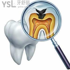 天津愛齒口腔舒適拔牙雙11優(yōu)惠價(jià)格