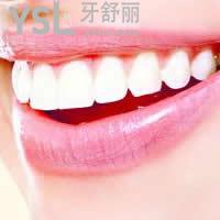 天津愛齒口腔皓齒美白牙齒雙11優(yōu)惠價(jià)格