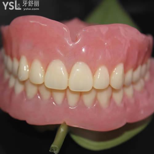 深圳貝臣口腔?吸附性全口義齒價格表