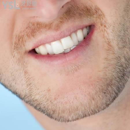 廣州曙光醫(yī)院口腔中心國產(chǎn)鋼絲美學(xué)矯正價格表