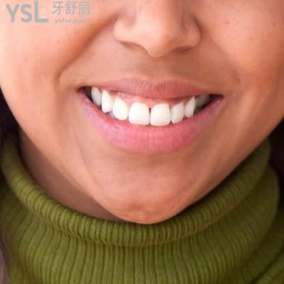 北京瑞泰口腔醫(yī)院金屬托槽矯正收費標準