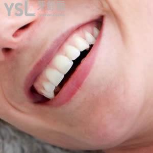 南寧柏樂口腔國產(chǎn)金屬自鎖托槽矯正價格貴嗎？請把“嗎”去掉。