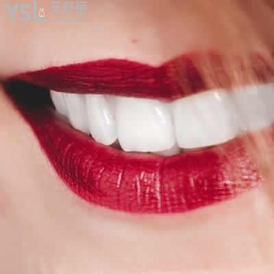昆明長鵬口腔超聲波洗牙收費(fèi)標(biāo)準(zhǔn)來襲