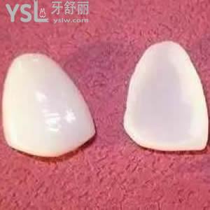 深圳拜爾口腔牙齒美白貼面價格