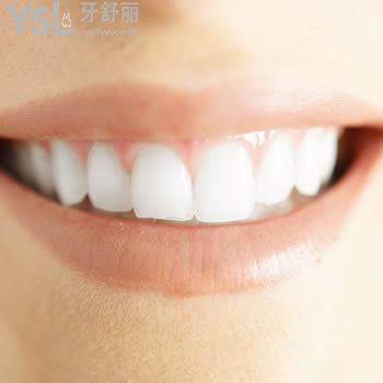 揭曉佛山春芽口腔怎么樣?公開佛山春芽口腔美加貼面價格表