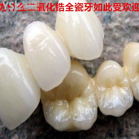 ?包頭植諾口腔做愛爾創(chuàng)全瓷牙怎么樣?公布本院愛爾創(chuàng)全瓷牙價(jià)目表及案例