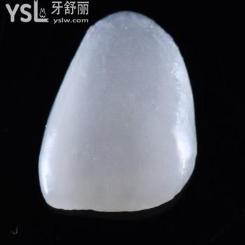 剛更新的廣州瑞德口腔E-max鑄瓷貼面價目表及優(yōu)勢