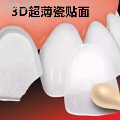 沈陽歡樂口腔3D超薄美牙瓷貼面價格貴不貴？僅供參考顧客評價