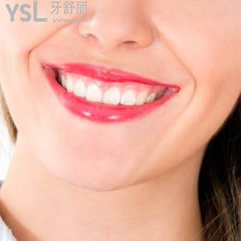 沈陽歡樂口腔皓齒美白靠譜嗎？?jī)r(jià)格貴不？且看醫(yī)生怎么說？