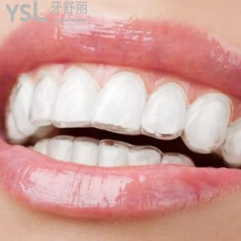 公布深圳雅適美口腔時代天使comfos價格表及深圳牙科醫(yī)院前十位排名