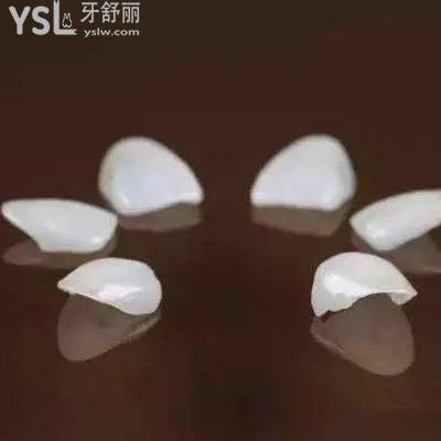 沈陽億美佳口腔納米仿生樹脂貼面收費標準