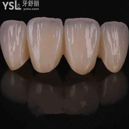 深圳質(zhì)美口腔澤康全鋯冠收費(fèi)標(biāo)準(zhǔn)