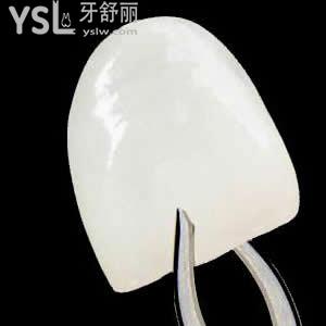 深圳質(zhì)美口腔美國美加超薄貼面價格表