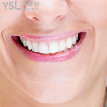 重慶維樂(lè)口腔韓國(guó)進(jìn)口種植體+基臺(tái)+烤瓷牙冠+手術(shù)費(fèi)價(jià)格表