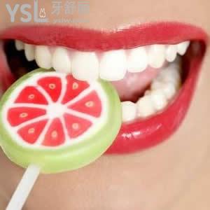 重慶美奧口腔冷光美白收費(fèi)合理嗎？