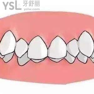 天津中諾口腔牙齒矯正價(jià)格一般是多少錢？