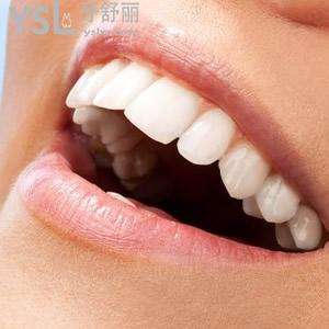 西安美奧口腔時代天使隱形矯正價格表